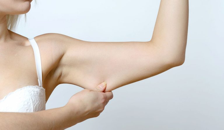 Arm plastic surgery with Dr. Mohamed Ashraf El Meligy